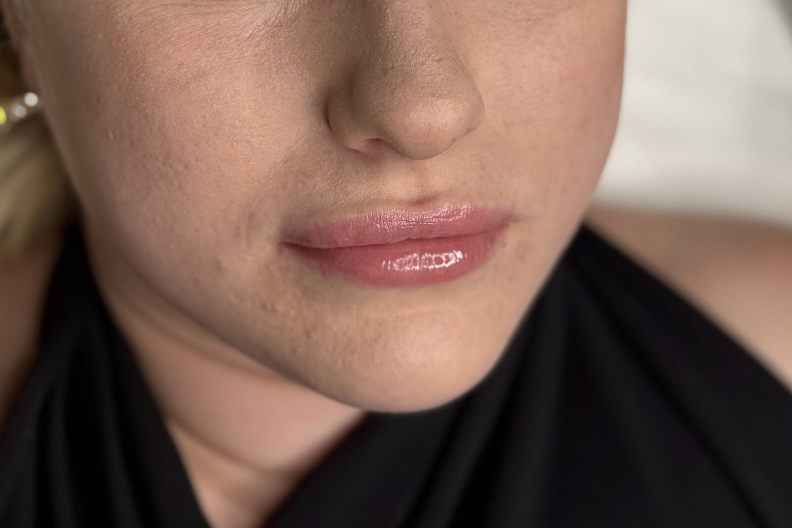 Lippen vor der Lip-Blush-Behandlung: blasse Farbe, weiche Kontur